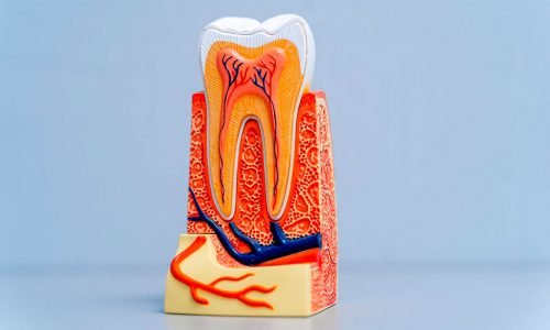 Aperfeiçoamento em Endodontia